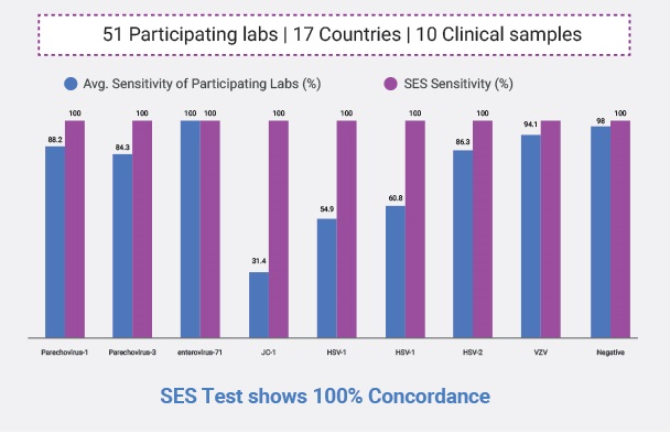 SES Test for cns infections