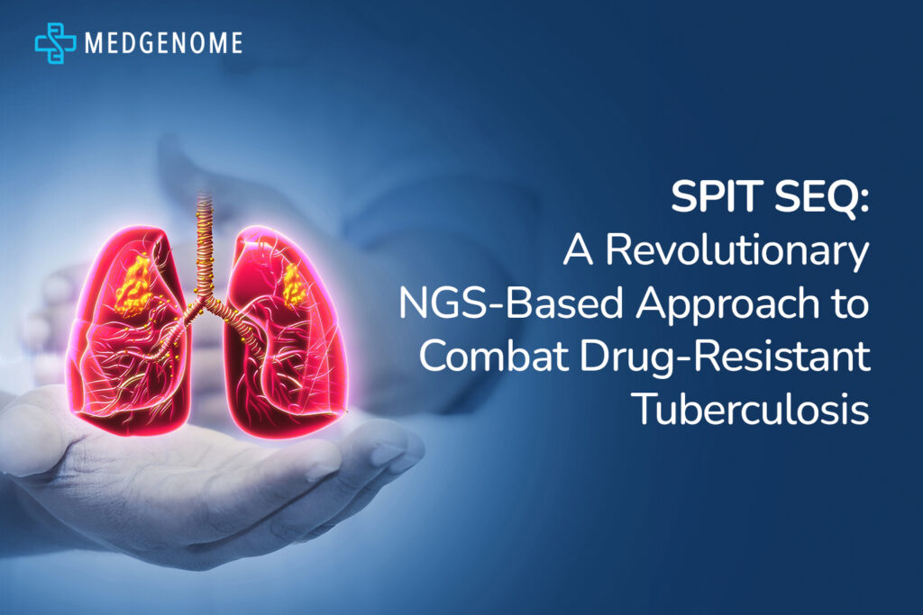 SPIT SEQ and Next-Generation Sequencing Combat Drug-Resistant Tuberculosis