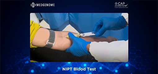 NIPT Blood Test: Blood Sample Collection Procedure for NIPT Testing